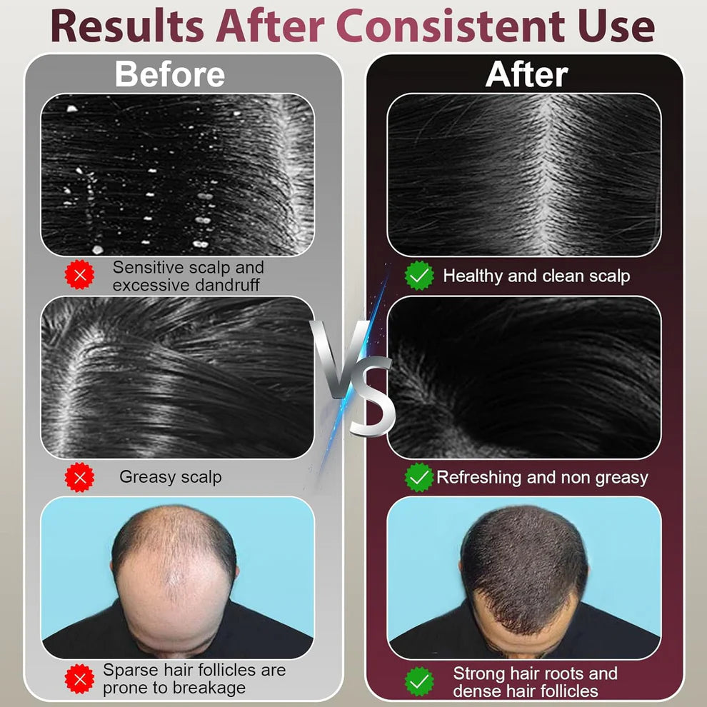 Laser Hair Growth Comb & Sculp Massager